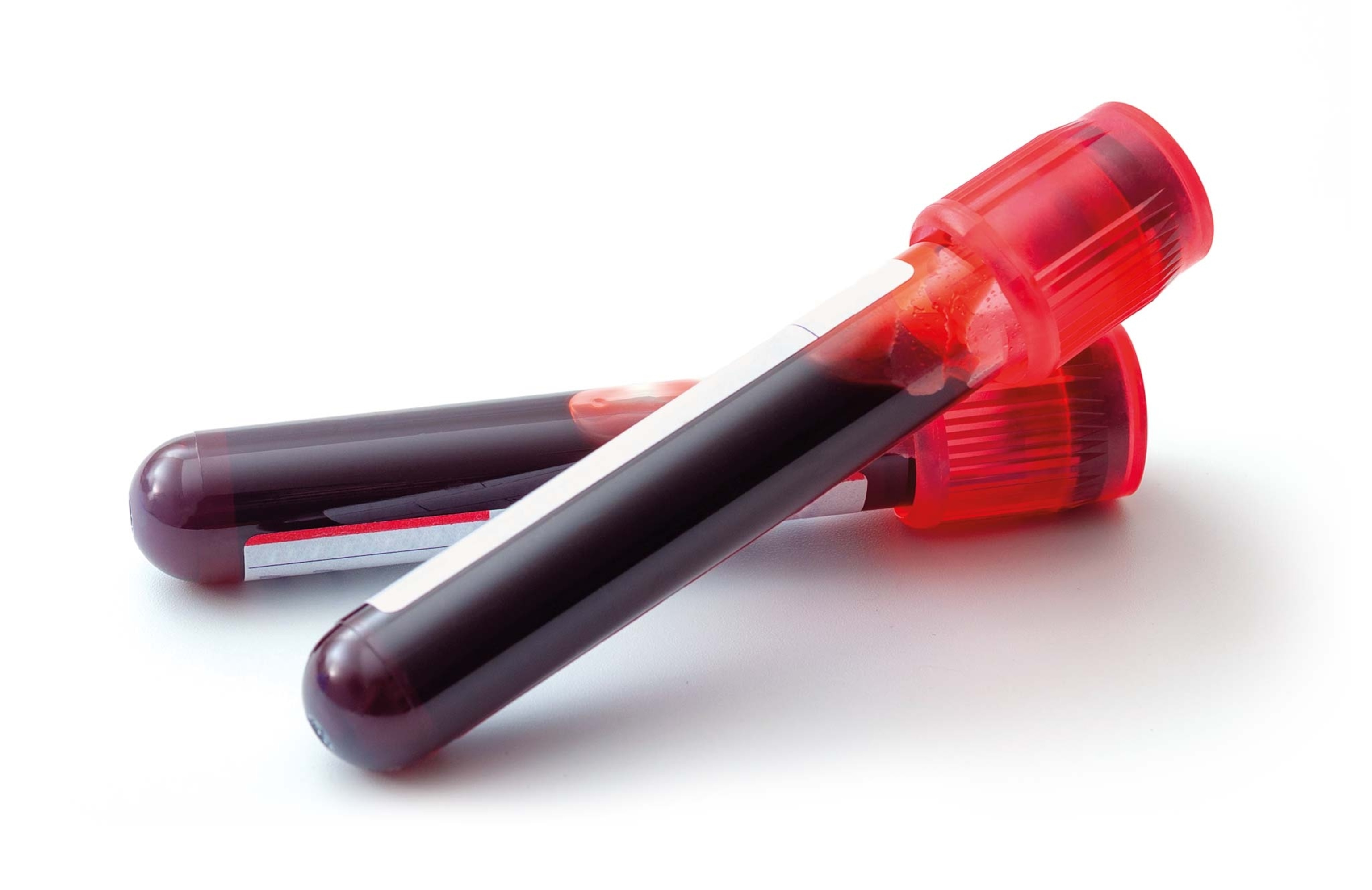 Test tubes containing samples of blood taken from donors