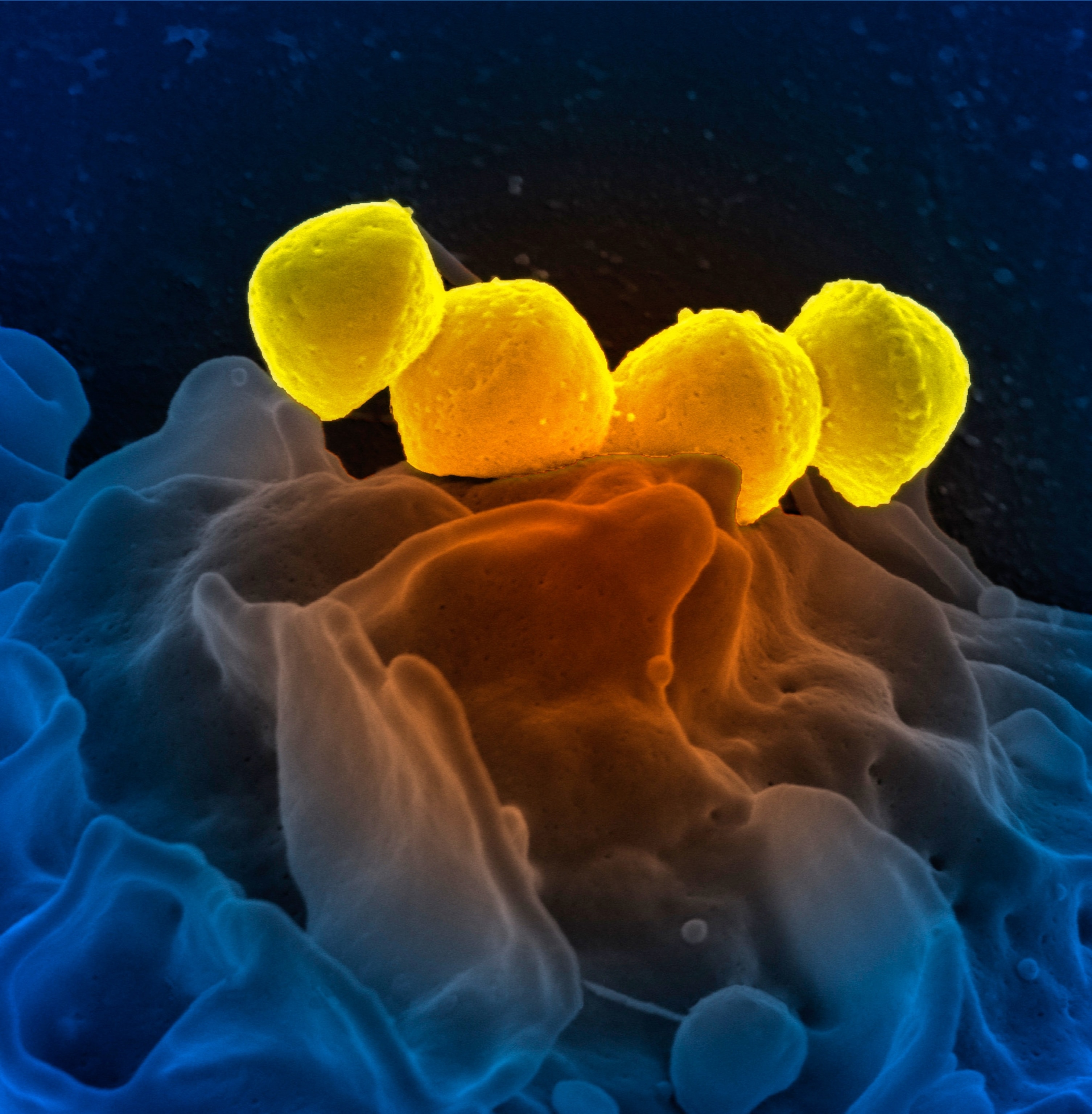 Microscopic image of five bright yellow, spherical bacteria on a textured surface with blue and orange tones.