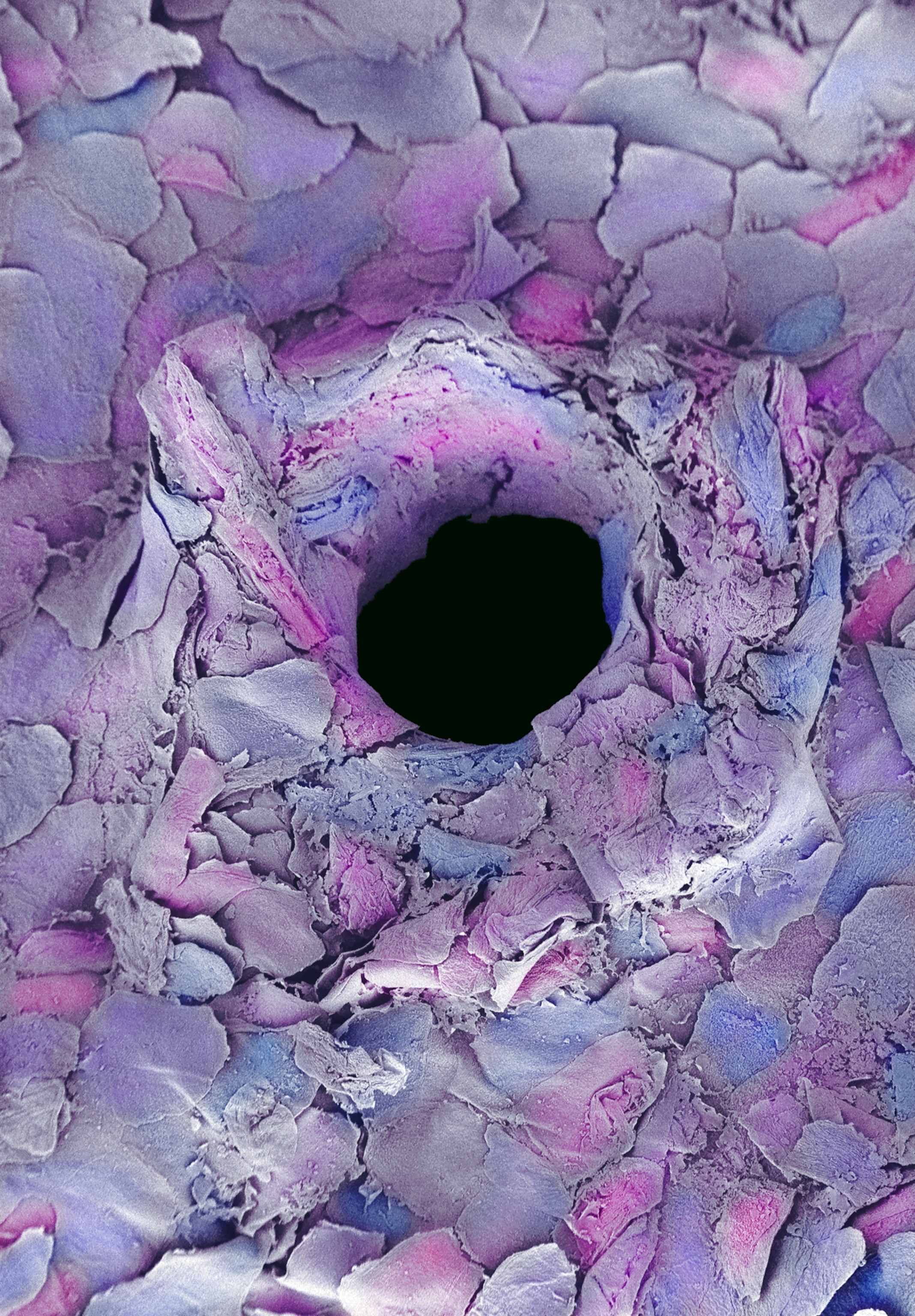 A colorized scanning electron microscopic view of skin where a puncture hole is visible, left behind by a tattoo needle
