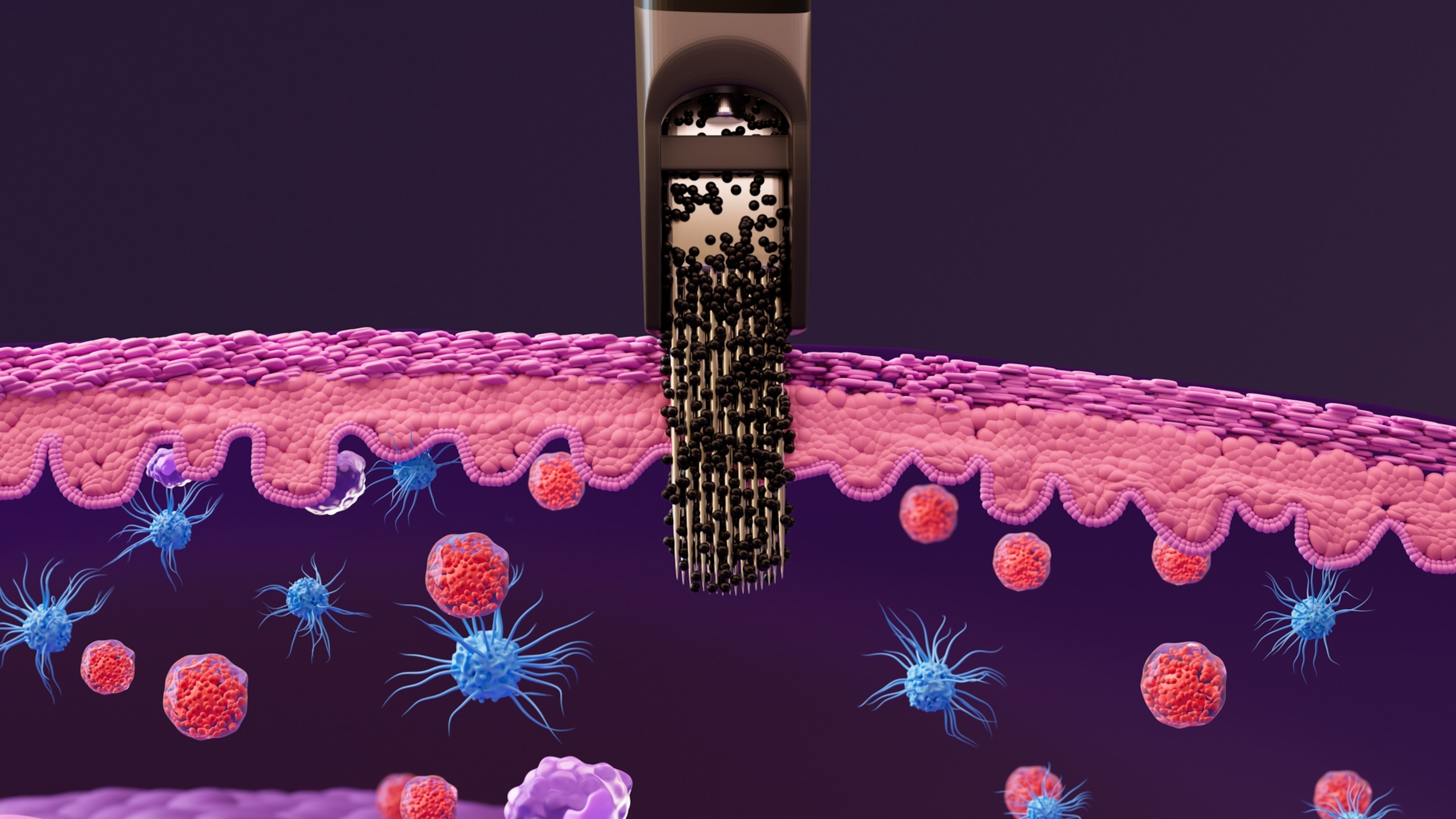 An illustrated cross-section of skin as it is penetrated by a tattoo needle. Droplets of ink pass by the epidermis into the dermis, where they encounter red and white blood cells